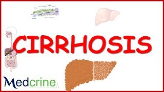 Cirrhosis Bile Salts amp Your Microbiome – Liver Disease Treatment Dr Berg [upl. by Russi]