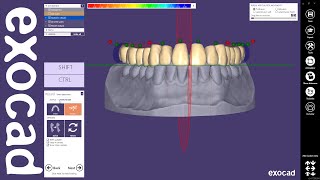 exocad Quick Guide Designing a single arch denture [upl. by Savart]