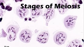 Stages of Meiosis [upl. by Britni91]