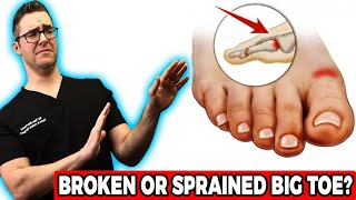 Broken Big Toe or Sprained Big Toe Joint BEST Home Treatment 2022 [upl. by Cassiani]