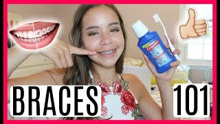 Braces 101 Advice Tips Tricks amp What to Expect 1 year Experience [upl. by Brookes]