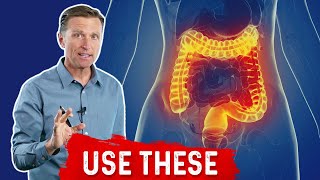 Diverticulitis Causes SIgns and Symptoms Diagnosis and Treatment [upl. by Sneve]