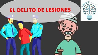 EL DELITO DE LESIONES [upl. by Yngiram]