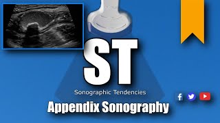 Appendix Ultrasound [upl. by Paresh]