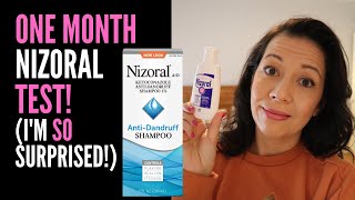 HAIR LOSS SUFFERER REVIEWS NIZORAL SHAMPOO One Month Review On 2 Ketoconazole IM VERY SURPRISED [upl. by Lindsey]