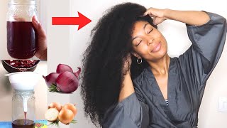 HOW TO USE ONION DECOCTION FOR MASSIVE HAIR GROWTH  ONIONS FOR EXTREME HAIR GROWTH [upl. by Alia]