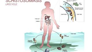 Webinar Schistosomiasis  Diagnosis and Treatment 2014 [upl. by Yoshi]