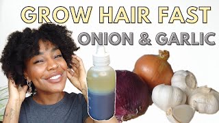 ONION AND GARLIC hair oil for RAPID hair growth and REDUCE HAIR FALL [upl. by Handbook]