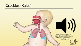 Respiratory Assessment by B Leary L DelSignore  OPENPediatrics [upl. by Rhyner]