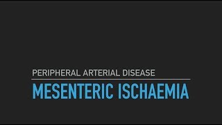 Mesenteric Ischaemia [upl. by Brad]