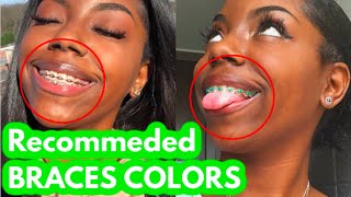 Choose THESE COLORS on your next braces appointment [upl. by Anastase274]