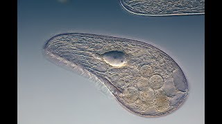 Microbiology of Eukaryotes Protozoa [upl. by Yrevi443]