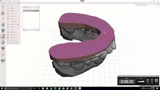 Video 4 of 5 MeshMixer  Dental Model Adding A Base [upl. by Siloum]