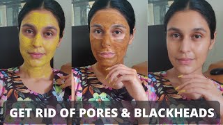 3 DIY MASKS FOR ENLARGED PORES BLACK amp WHITEHEADS  100  Natural Remedies  Chetali Chadha [upl. by Kinch]