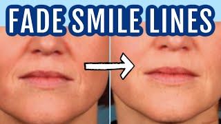 12 ways to fade smile lines nasolabial folds Dr Dray [upl. by Carling]