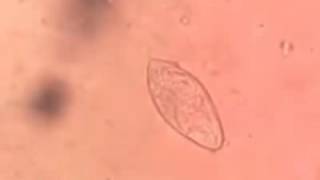 Schistosoma haematobium egg [upl. by Telford]