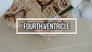 Fourth ventricle  neuroanatomy  floor  opening [upl. by Iztim559]