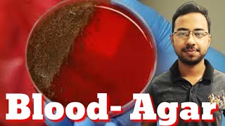 Blood agar media preparation in Hindi  culture media microbiology  microbial growth microbiology [upl. by Aryk]