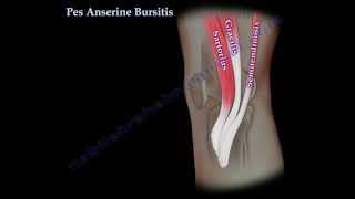 Pes Anserine Bursitis  knee pain  Everything You Need To Know  Dr Nabil Ebraheim [upl. by Monarski]