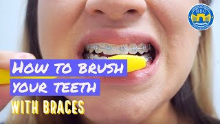 How to Brush with Braces  3 Brushing Tips [upl. by Liam885]