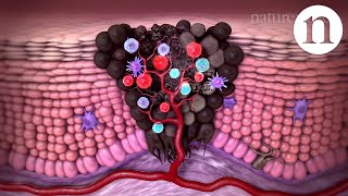 Tumour immunology and immunotherapy [upl. by Almallah]