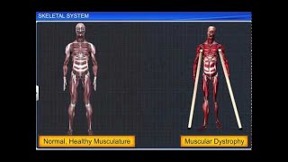 CBSE Class 11 Biology  Skeletal System [upl. by Enomas]