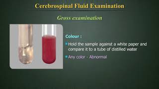 Cerebrospinal Fluid Examination CSF [upl. by Abrahan]