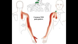 Macleods examination of the facial VII nerve [upl. by Assenal]