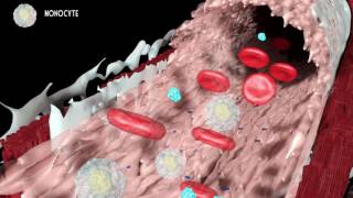 Development of atherosclerosis [upl. by Cressi]