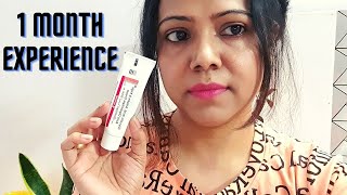 My 1 Month Experience with Demelan Cream  Honest Review [upl. by Enail]