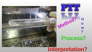 Prothrombin Time Test PT Hematology [upl. by Nylirem]