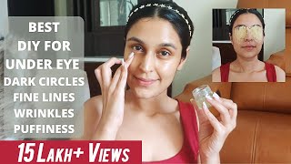 DIY for DARK CIRCLES WRINKLES amp PUFFINESS  Most Affordable amp Results in 2 Weeks  Chetali Chadha [upl. by Mercado382]