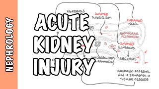 Acute Kidney Injury AKI  prerenal intrarenal and postrenal causes and pathophysiology [upl. by Llewoh363]