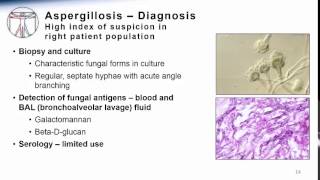 Aspergillosis [upl. by Aihsotal271]