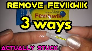 how to remove fevikwik from hand [upl. by Esmaria]