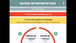 ROTEM in 5 minutes [upl. by Oer]