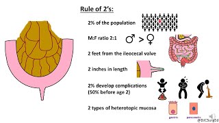 Complicated Sigmoid Diverticulitis Graphic [upl. by Nealah]