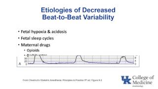 Antepartum fetal surveillance [upl. by Ecadnak73]