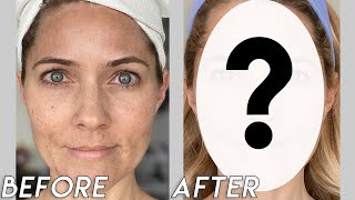 Musely Face Rx  Did it Work I tried Musely to treat my Melasma  Over 40 [upl. by Maclay419]