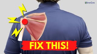 How to Fix Shoulder Snapping and Pop Sounds NO EQUIPMENT [upl. by Eisler553]