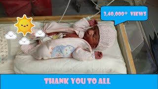 My Baby Born at 35 Weeks Premature Birth [upl. by Nalek]