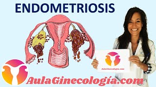 ENDOMETRIOSIS I patogenia síntomas y diagnóstico  Ginecología y Obstetricia [upl. by Ahseram]