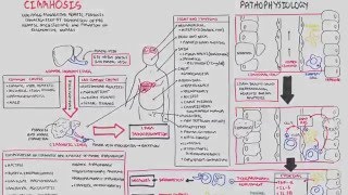 Liver Cirrhosis SandS Pathophysiology Investigations Management [upl. by Annasoh]