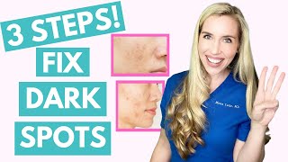 Fix Your Dark Spots in 3 Steps  Hyperpigmentation  Melasma  Skincare Made Simple [upl. by Eilsek425]