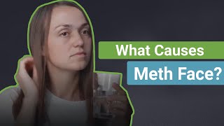 What Causes Meth Face [upl. by Beaumont]