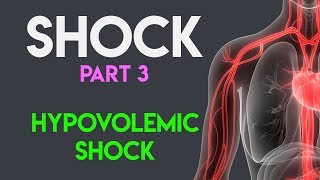 Hypovolemic Shock  Shock Part 3 [upl. by Aryajay228]