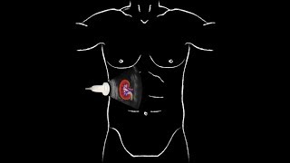 Liver Palpation  Different Methods [upl. by Bertina]