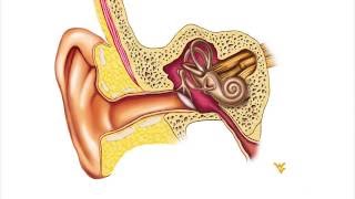 Menieres Disease  WVU Medicine Health Report [upl. by Tutto]