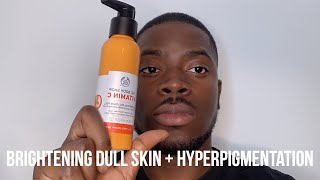 HOW I GOT RID OF DARK SPOTS BRIGHTEN DULL SKIN  HYPERPIGMENTATION [upl. by Annahsirhc774]