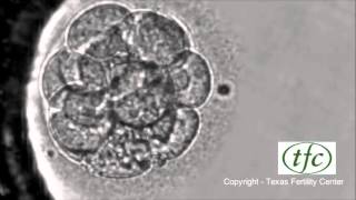 Human Embryo Growing from Fertilization to Day 6 Blastocyst [upl. by Ttnerb]